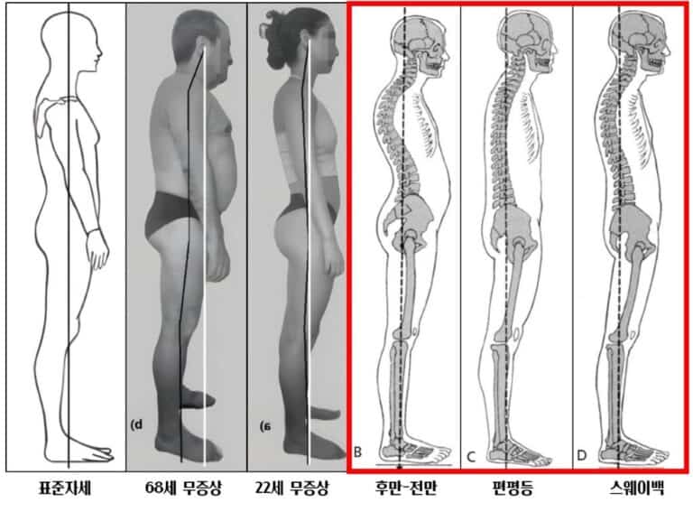 이상직언 자세그림