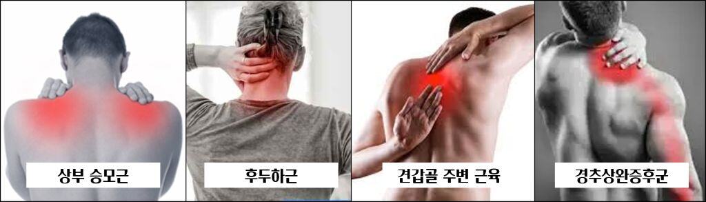 거북목통증패턴