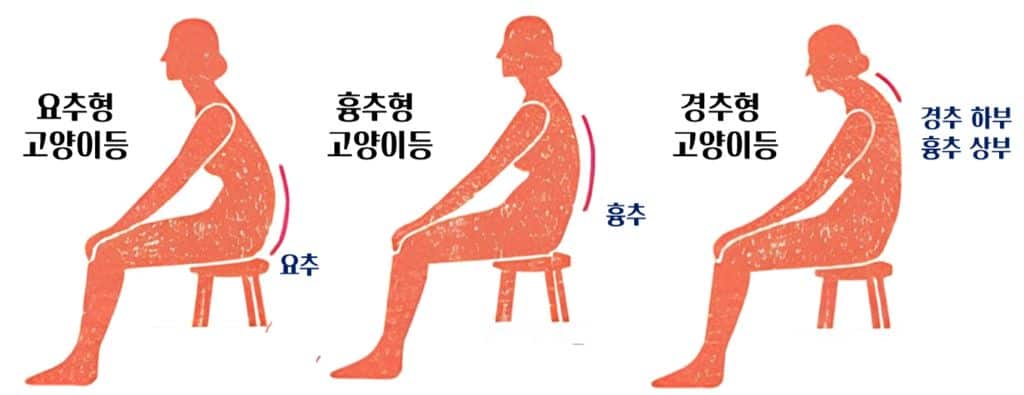 고양이등의분류