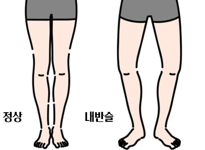 내반슬 e1744581155541
