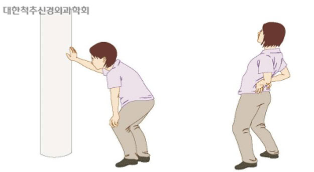 요추후만증