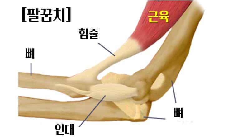프롤로치료힘줄인대