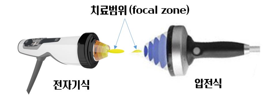 압전식전자기식