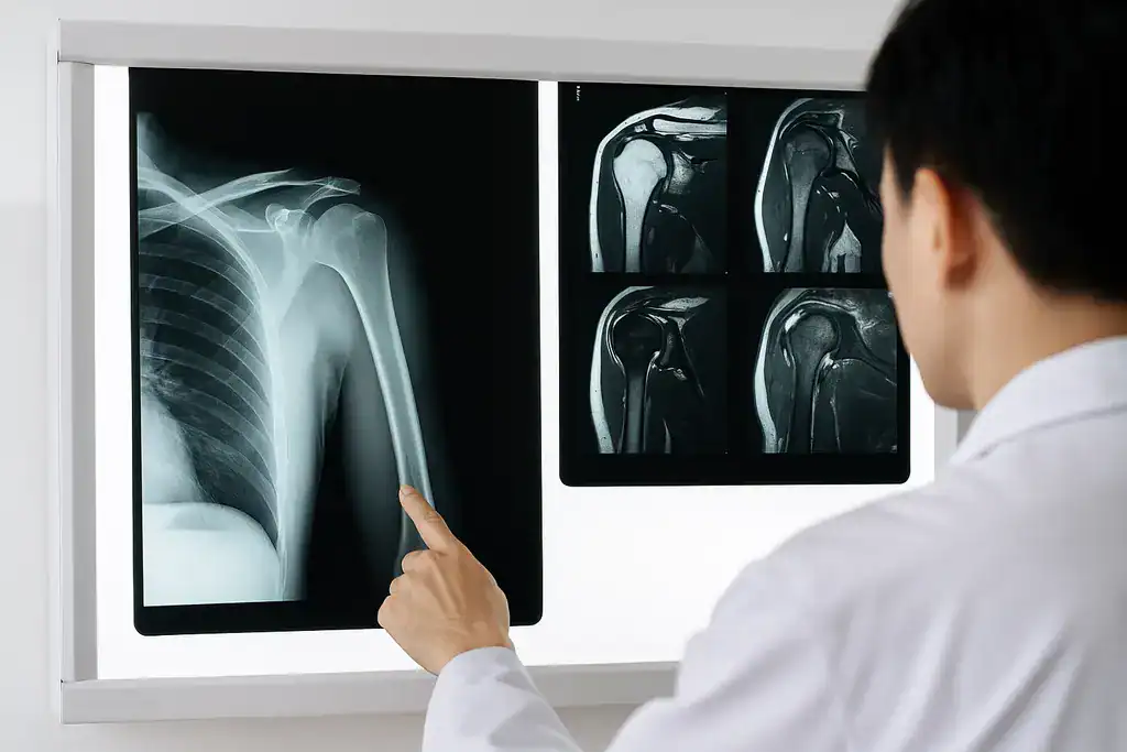 동일한 어깨 통증에도 다른 진단명이 발생할 수 있음을 설명하기 위해, 의료진이 병원 진료실에서 MRI 또는 X-ray 영상을 들여다보는 모습. 영상과 임상 판단을 통해 다양한 진단명을 비교하는 상황